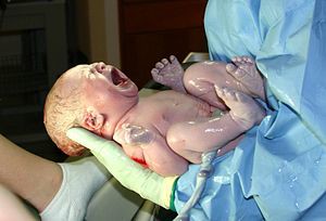 Birth Trauma, Newborn, Baby, Neck Injury, Upper Cervical