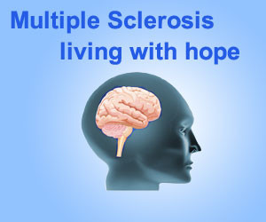 Multiple sclerosis, MS, Nervous System