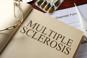 Multiple sclerosis, MS, Nervous System